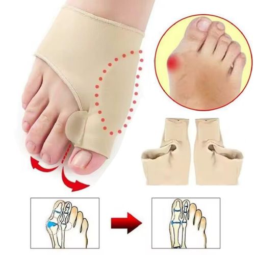 Correcteur Hallux Valgus (2 Paires) – Redresseur d'Orteils en Tissu Élastique, Corrige & Soulage la Douleur des Oignons du Pied, Confort & Alignement