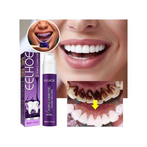 Dentifrice Mousse Blanchissante 50ml - Nettoyage en Profondeur, Rafraîchissant et Élimination de la Plaque