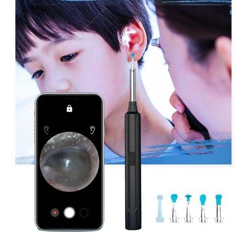 EarCam Pro Blanche