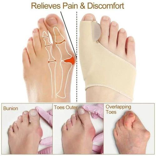 Pack 2 hallux valgus orthese corrective pour soulager la douleur