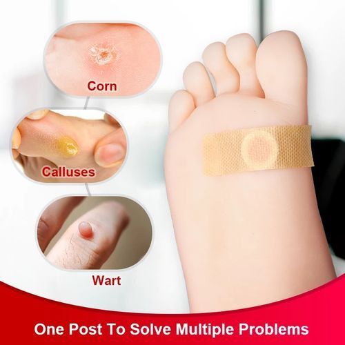 لصاقات علاج مسمار القدم 12