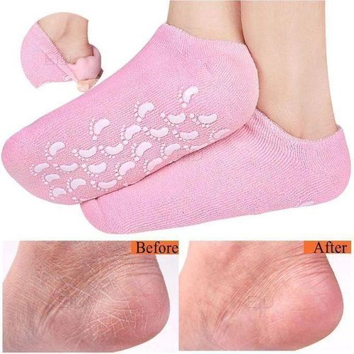 Chaussettes de Soin pour Pieds Secs et Craquelés – Lot de 2 Paires