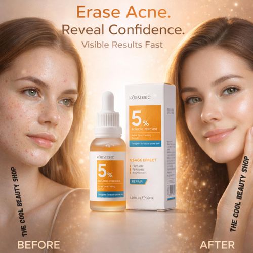 Serum Anti-Acné 5% Peroxyde de Benzoyle – Anti Boutons & Taches- Peau Nette 30ml
