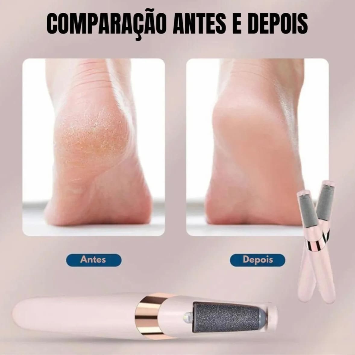 Lixa Removedor De Calos Eletrico Para Pes Recarregavel 7