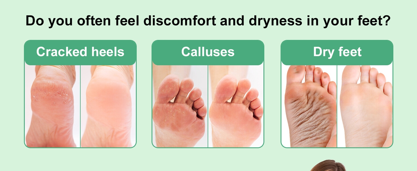 Moisturizing Socks 2