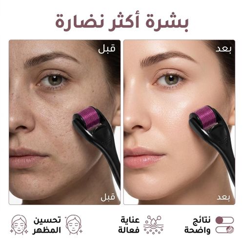 Derma Roller 540 micro-PIC titane 0.25mm, Rouleau microneedling visage barbe cheveux, Soin peau et stimulation capillaire
