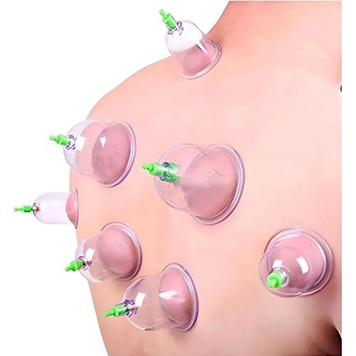 Kit Hijama Professionnel 12 Ventouses Massage Relaxation Corps