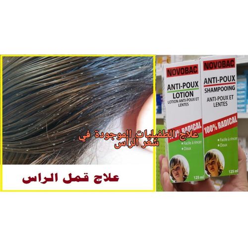 شامبو ضد القمل + لوشن ضد القمل