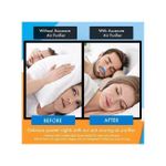 product_image_name-Generic-Acusnore Bleu – Purificateur d’Air al et Réducteur de Ronflements-6