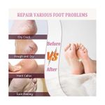 product_image_name-Generic-Spa Chaussettes Gel Socks - Spa de Mascot Europe-5