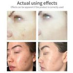 product_image_name-Aichun Beauty- Pack soins visage crème éclaircissante pour les yeux nettoyant visage sérum visage à la vitamine C 30ml-5