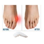 product_image_name-Generic-2 Kit Séparateur pour Hallux Valgus 2 Unités-3