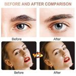 product_image_name-Generic-Épilateur facial électrique avec USB, pour le visage et les zones sensibles-5