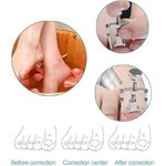 product_image_name-Generic-Outil d'ongle Incarné de Correction de Style D'ongle -3