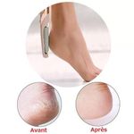 product_image_name-Generic-جهاز عناية القدم بالكهرباء – بشرة ناعمة وسلسة-2