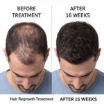 product_image_name-keratine queen-SPRAY Capillaire 5% Extra Strength pour Homme – Solution Topique 50ml -3