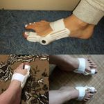 product_image_name-Generic-x2 - مصحح أصابع القدم-7