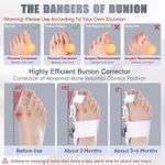 product_image_name-Generic-Correcteur d’Oignon Amélioré Unisexe – Attelle Orthopédique Professionnelle avec Redresseur d’Orteils et-7