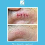 product_image_name-Generic-KELO-COTE Gel pour Cicatrices 6g-3