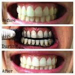 product_image_name-Teeth Whitening-مسحوق تبييض الأسنان مسحوق تنظيف تبييض الأسنان بالفحم الطبيعي-3