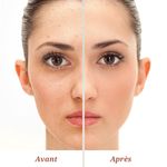 product_image_name-iDerm Paris-iDerm Paris - واقي شمس SPF 50+ غير مرئي - مضاد للبقع الداكنة، مضاد لللمعان - نياسيناميد، Dermawhite، فيتامين E - 50 مل-3