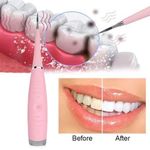 product_image_name-Generic-قشارة الأسنان الكهربائية الاهتزاز USB شحن أداة تنظيف الجير سونيك-1