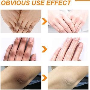 EELHOE Body Lotion - Lotion exfoliante blanchissante pour le corps - Exfoliation en profondeur, éclaircissement de la peau, et hydratation intense - Pour tout le corps - 100ml