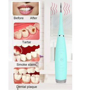 قشارة الأسنان الكهربائية المحمولة ، إزالة الجير