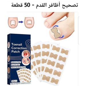 لاصقات تصحيحية لأظافر أصابع القدم