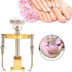 Correcteur d'Ongle Incarné Professionnel – Outil de Pédicure pour Soin des Pieds et Redressement de l'Ongle