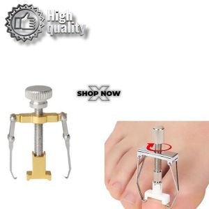 Correcteur d’Ongles Incarnés en Acier Inoxydable – Clip de Redressage Professionnel pour Pédicure, Traitement et Soins des Ongles des Pieds