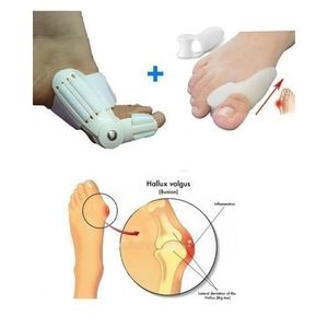 Pack 2 Correcteurs Hallux Valgus + 2 correcteurs silicone