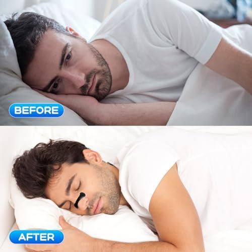 product_image_name-Generic-Dilatateur  pour une meilleure circulation de l’air-8