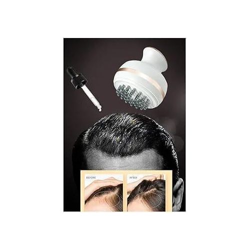Generic Masseur de tête électrique - image 3