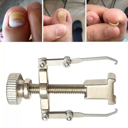 product_image_name-Generic-Correcteur d’ongle incarné réglable en acier-3