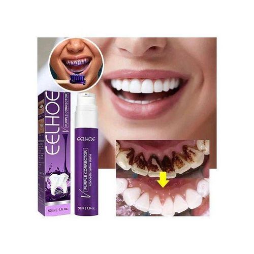 product_image_name-Generic-معجون أسنان بنفسجي لتبييض الأسنان، يزيل اللويحة السنية-1