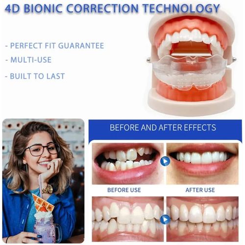 product_image_name-Generic-3 خطوات مصحح لتقويم الأسنان مدرب محاذاة جديد-2