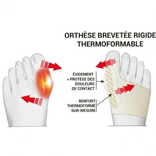 Orthèse rigide de nuit thermoformable EPITACT pour le pouce - Pouce do