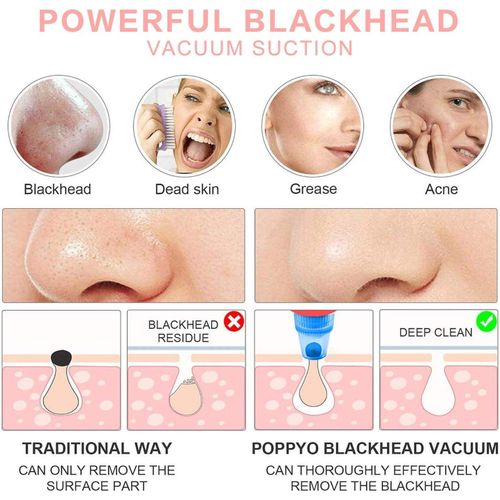 product_image_name-Generic-Mise en en avant du produit: Aspirateur à points noirs électrique avec technologie de vide pour un nettoyage en profondeur des pores, pour un teint éclatant.-3