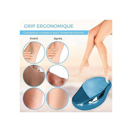 product_image_name-Generic-أداة إزالة الشعر غير المؤلمة وتقشير وتقشير آلة إزالة الشعر الصغيرة المحمولة لظهر ذراع الساق-2