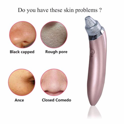 product_image_name-Generic-آلة تنظيف الوجه لتنظيف المسام وحب الشباب ، مزيل الرؤوس السوداء-3