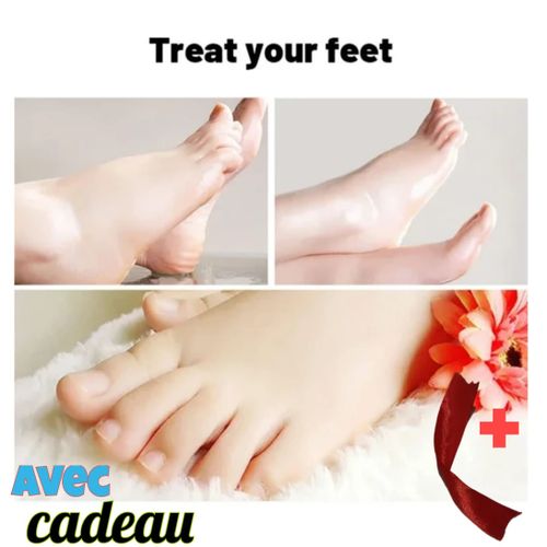 product_image_name-Aichun Beauty-Masque exfoliant aux pieds de banane (40g) *Blanchissant et hydratant* Élimine les peaux mortes et les callosités-5