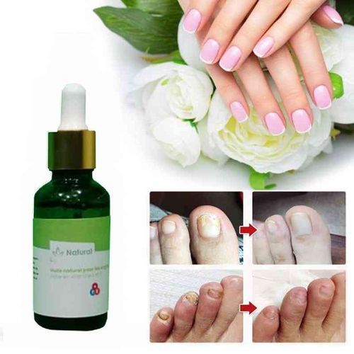 General Pack 2 Traitement Des Ongles Fongiques Soin Des Pieds Sérum