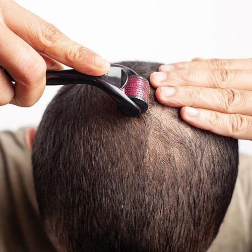 product_image_name-Derma Roller-Kit de rouleaux de croissance de la barbe pour hommes,-6