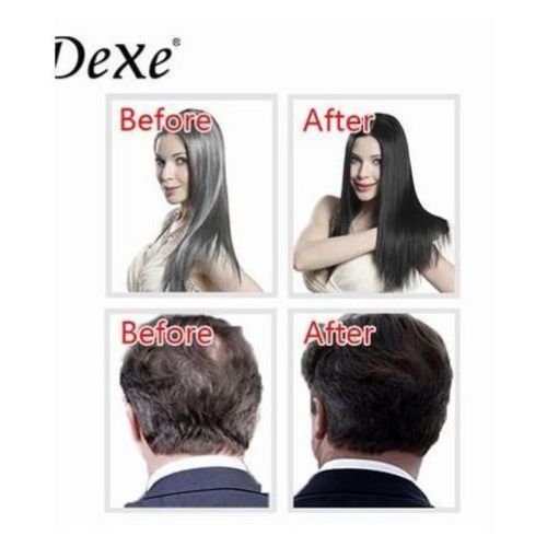 product_image_name-Subaru- LWS > Magic Black hair shampooing 400 = 200 ML + 200 ML-7