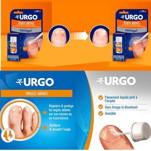 Urgo Filmogel Ongles Abîmés Par Mycoses & Traumatismes Flacon 3,3ml