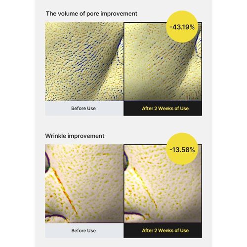 product_image_name-celimax-Retinol Shot Tightening Serum 30ml-4