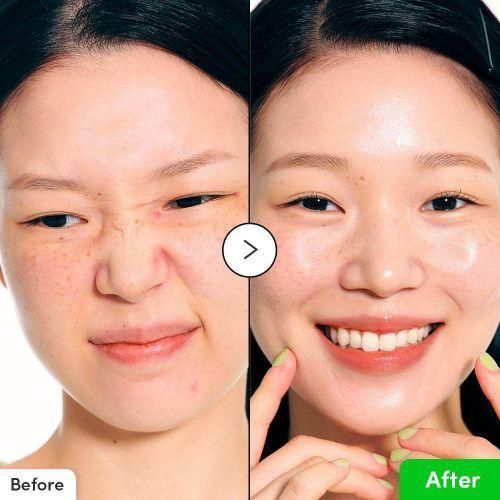 product_image_name-EQQUAL BERRY- Sérum Calmant Aloe PDRN-2