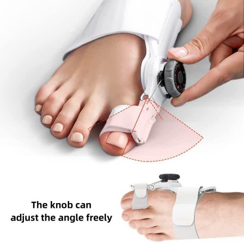 product_image_name-Generic-Correcteur d’Oignon Orthopédique Réglable – Attelle Rotative Hallux Valgus avec Coussinets-2