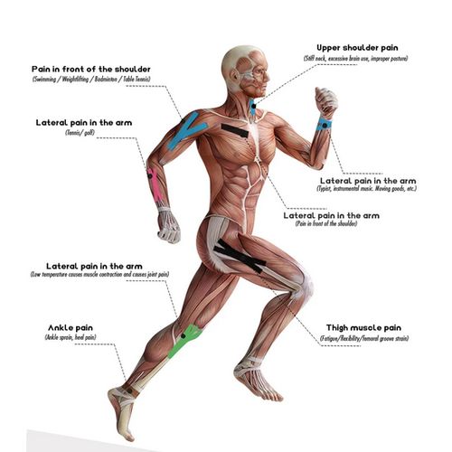 product_image_name-Generic-شريط لاصق مرن لدعم الحركة 5 م لمختلف الإصابات العضلية، شريط مرن للتعافي الرياضي، دعامة الركبة، ضمادة اللياقة البدنية-8